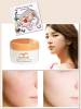 Kem trị tàn nhang, trị nám nhau thai cừu Rebirth - anh 1